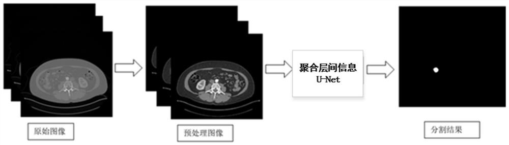 基于聚合层间信息的U-Net肾脏肿瘤图像分割方法、设备及存储介质