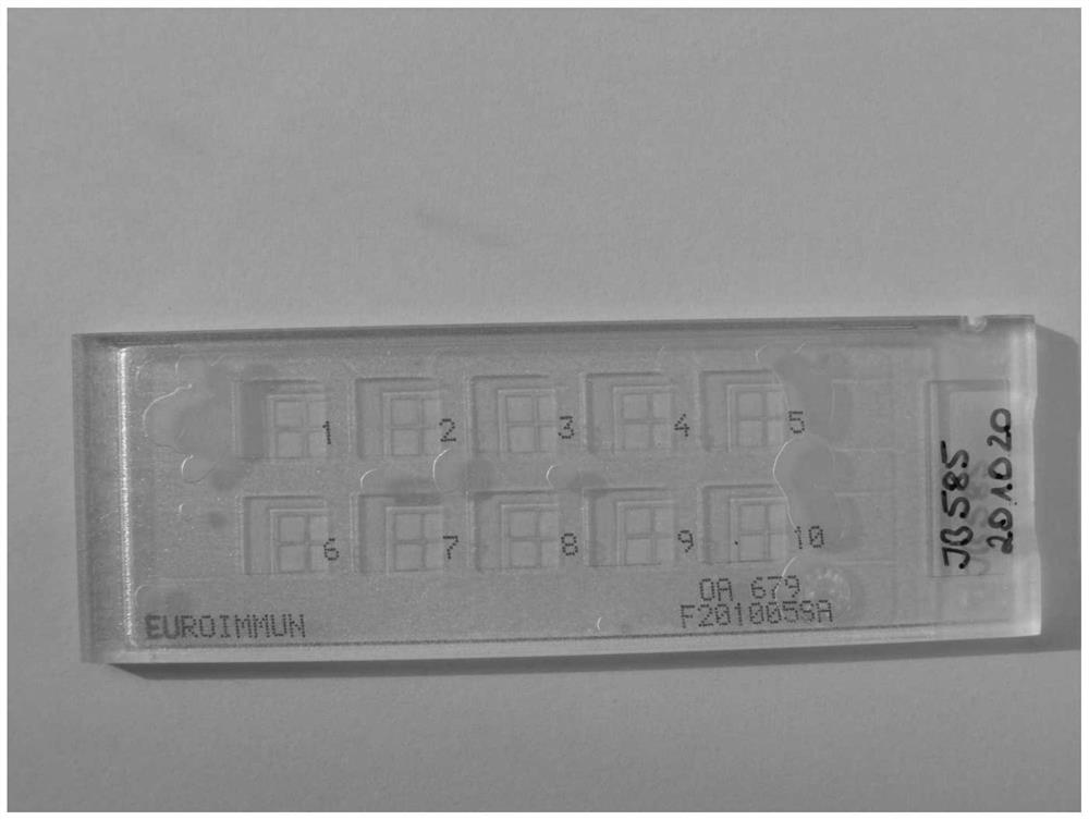 用于检测针对乙酰胆碱受体的自身抗体的方法