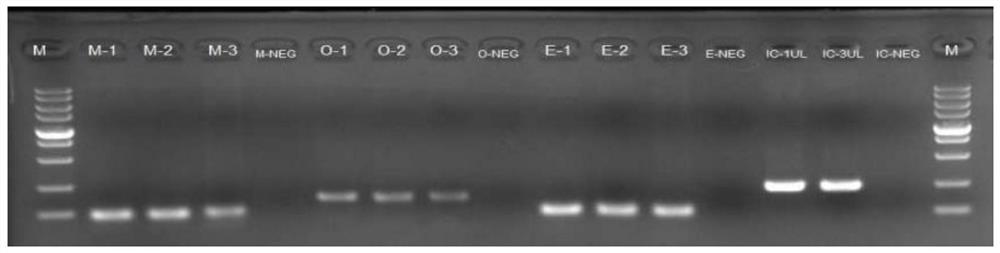 用于2019-nCoV和SARS病毒PCR检测的内参基因、试剂盒及检测方法
