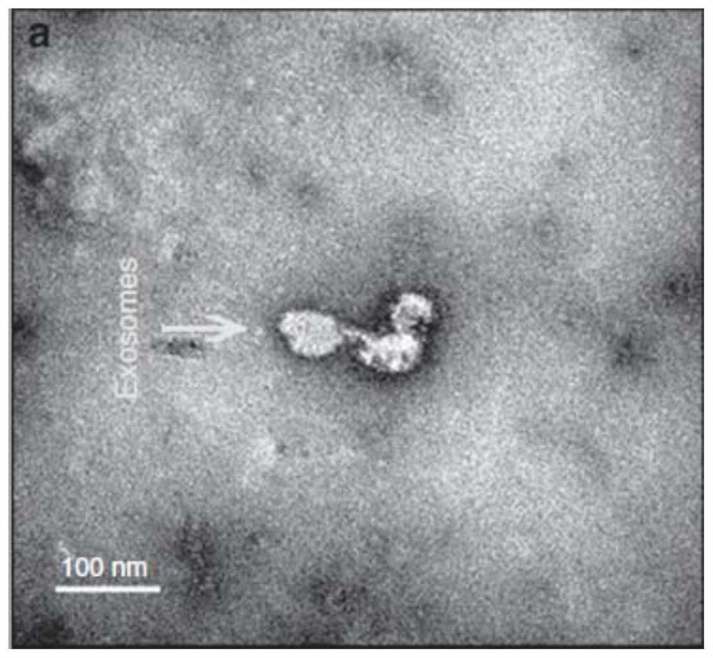 一种母乳外泌体及其制备方法与应用