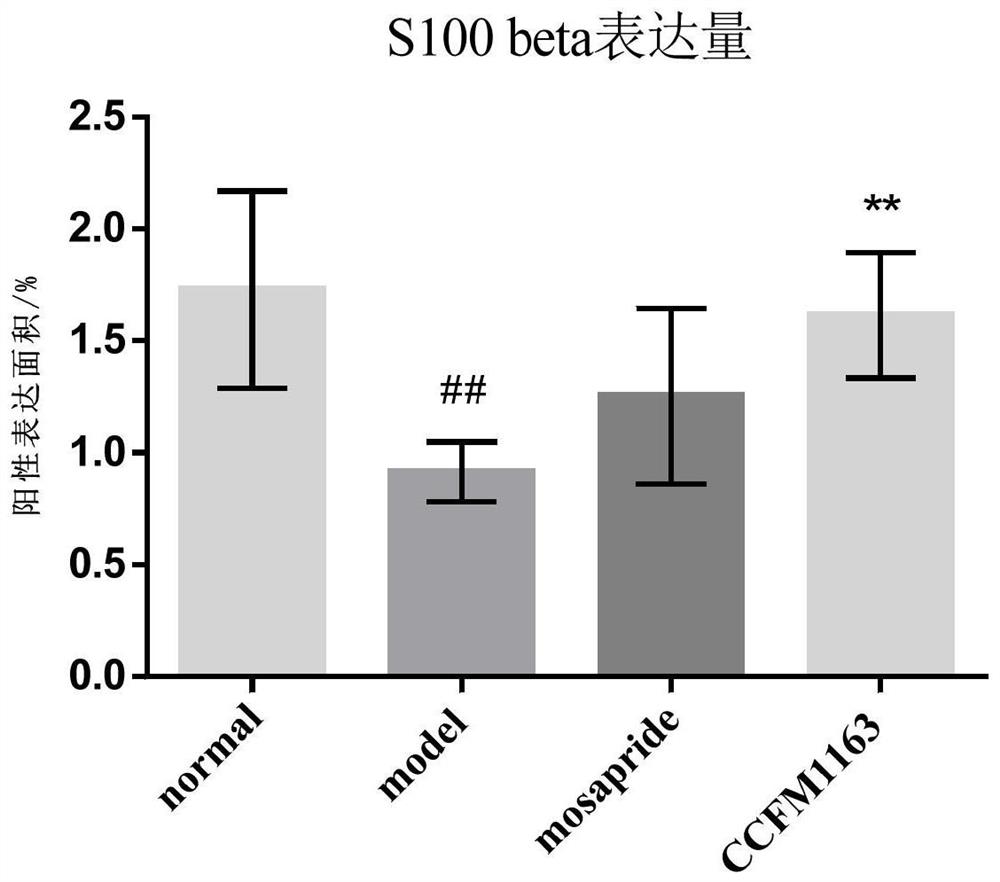 一株缓解泻剂结肠的两歧双歧杆菌及其应用