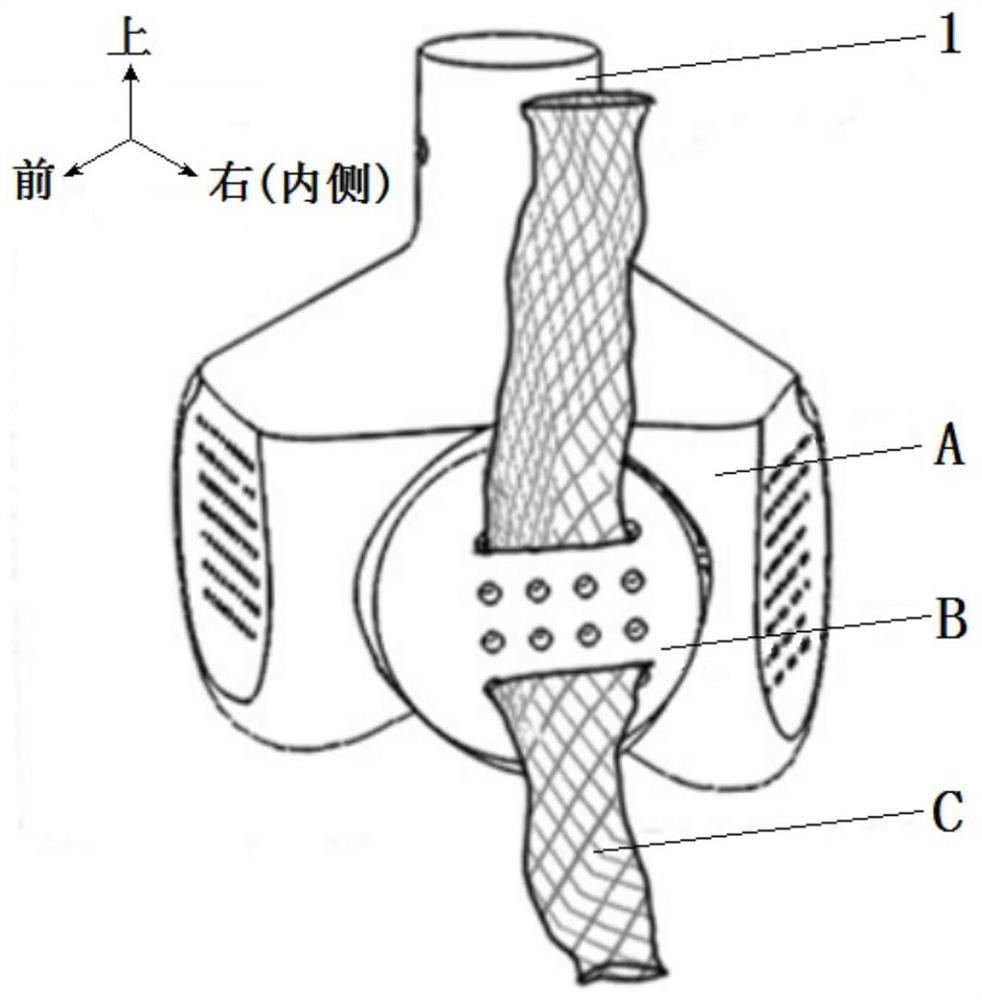 一种用于双足行走机器人的节能仿生拉压体髌股关节