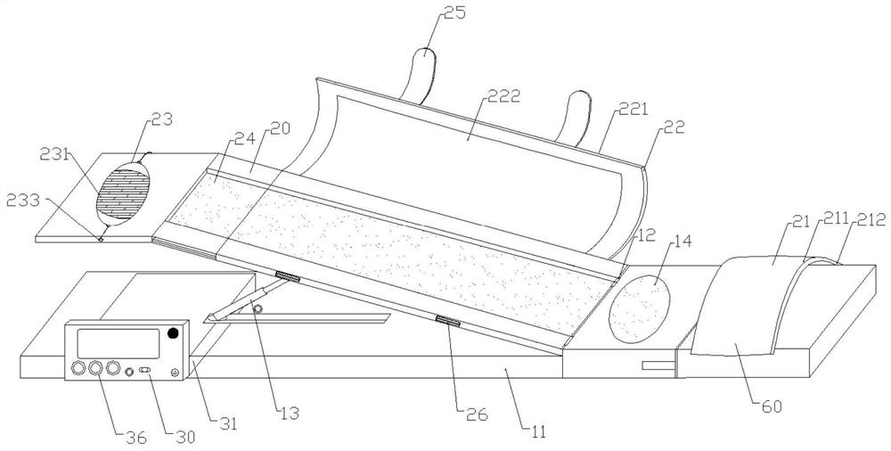 血液透析患者自体动静脉内瘘锻炼器具