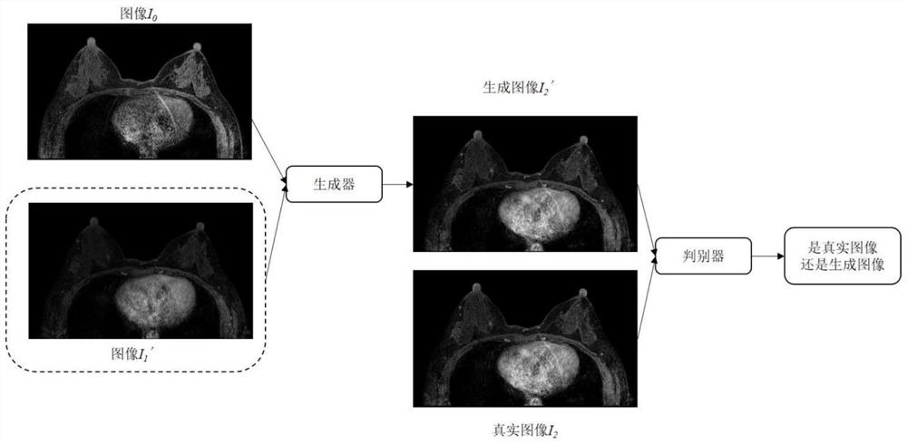 基于多约束GAN的DCE-MRI图像生成方法