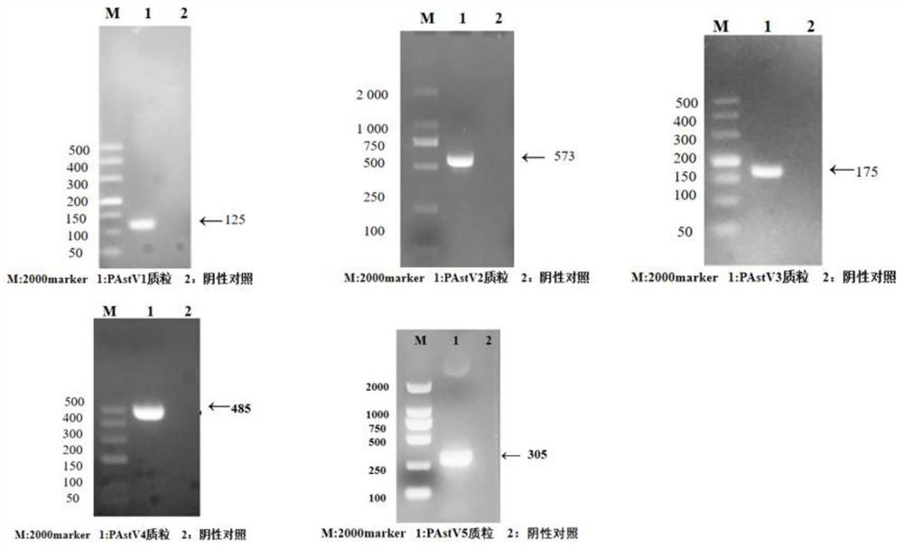 用于检测猪星状病毒的多重RT-PCR引物组、试剂盒及其应用