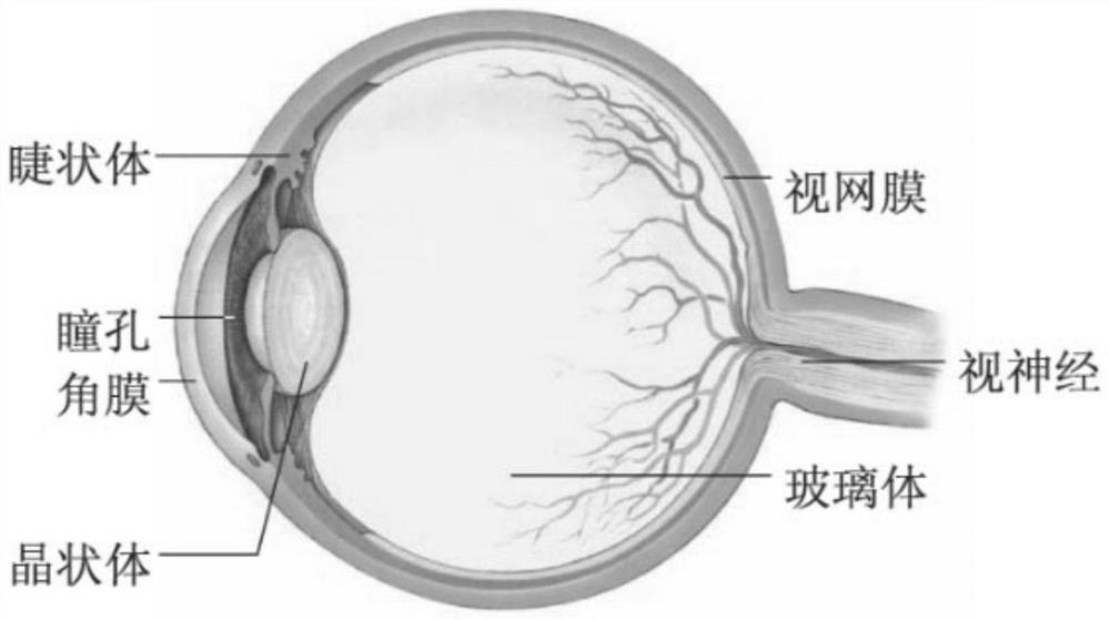 眼球玻璃体切割治疗系统