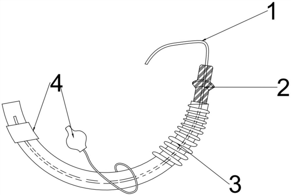 一种螺旋可收缩管型单腔气管导管