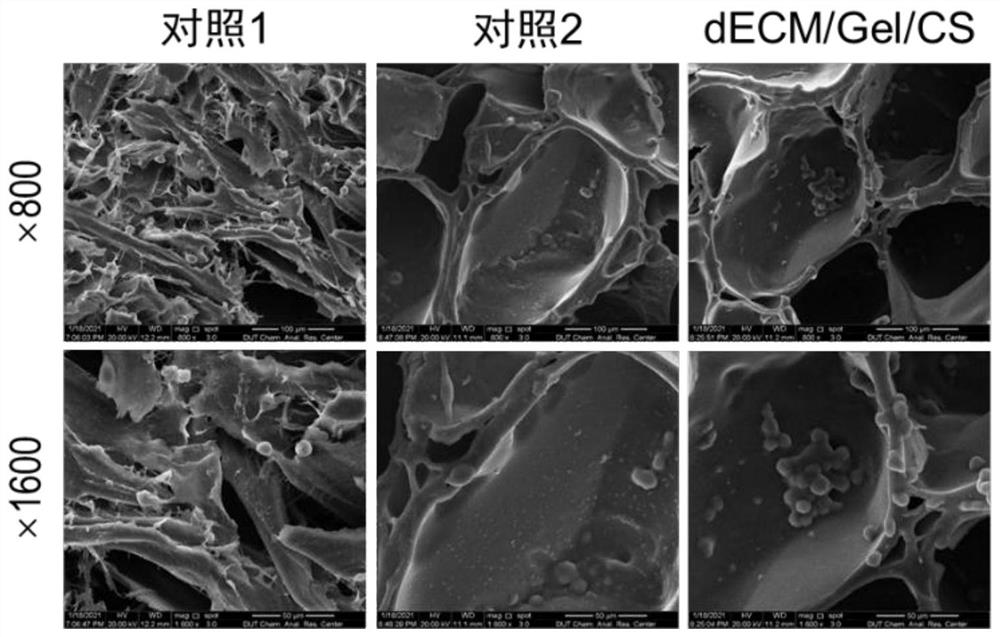 一种基于皮肤源脱细胞基质衍生支架及其构建方法