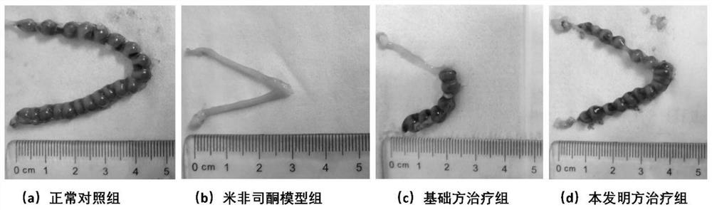 一种用于治疗不孕症的中药组合物及其制备方法、应用