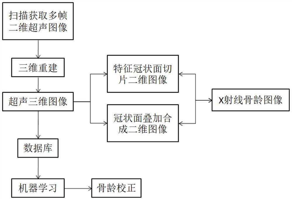 一种超声骨龄检测方法