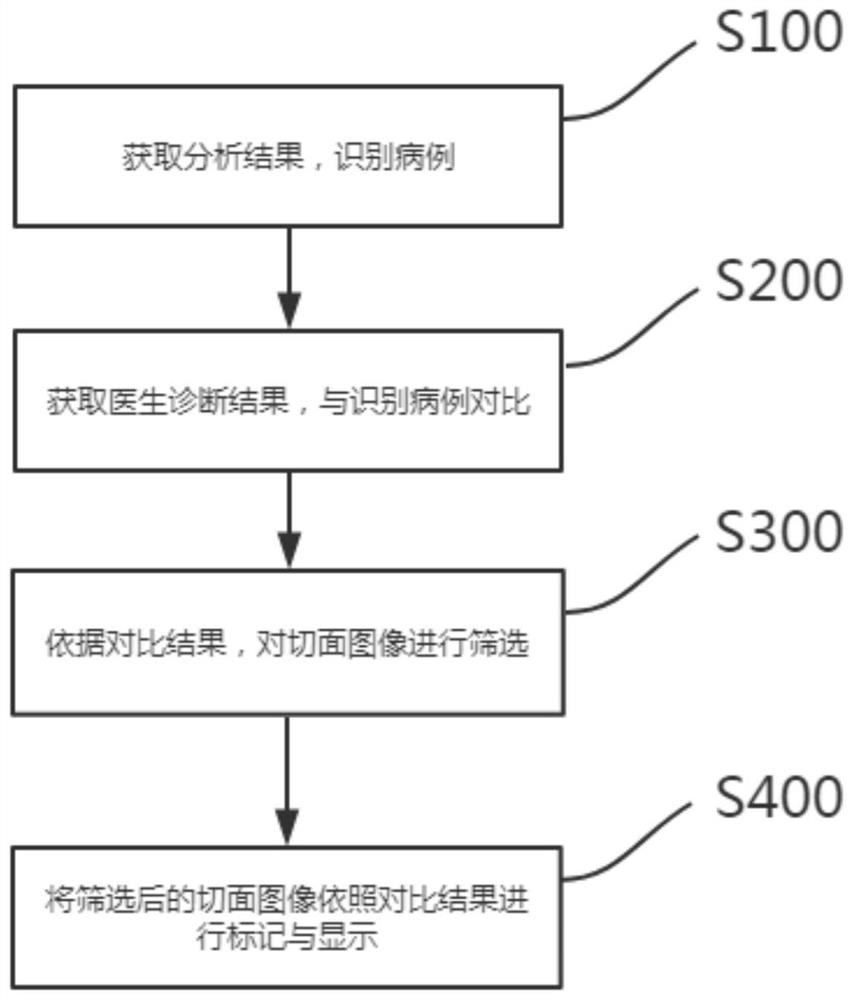 基于人工智能的超声检查的智能提醒方法