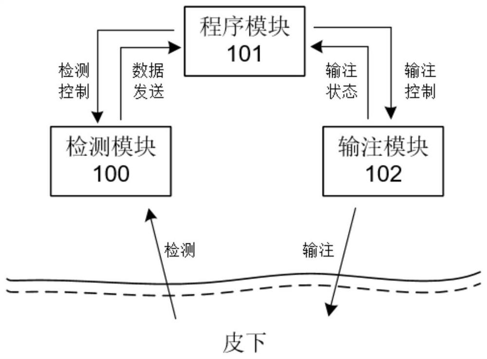 单边驱动闭环人工胰腺