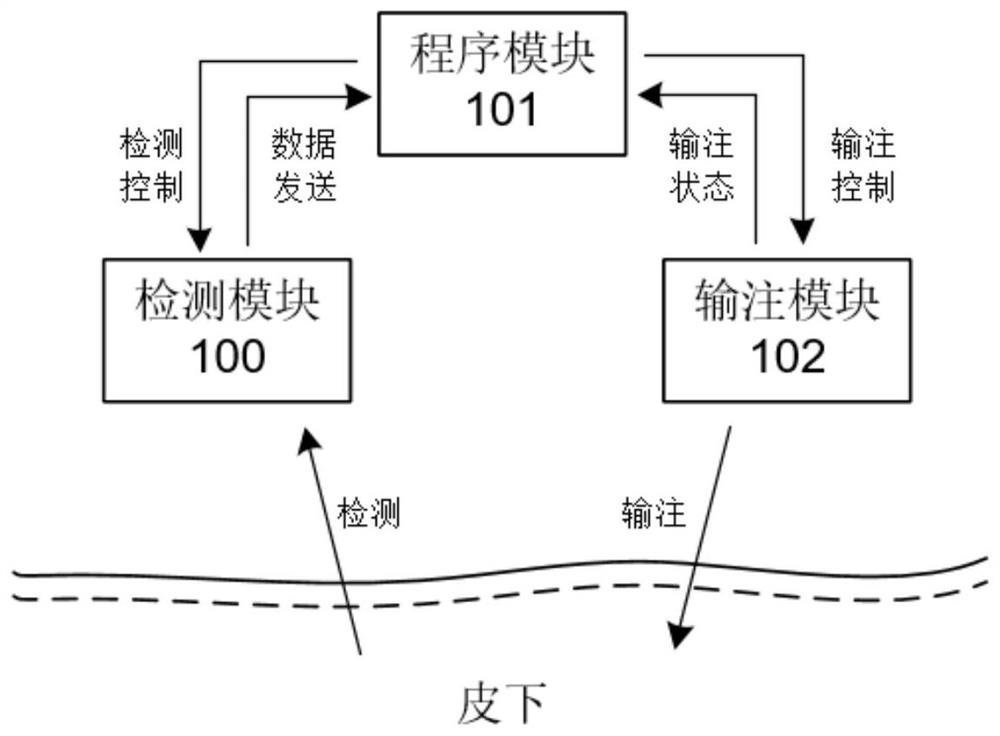 集成型闭环人工胰腺