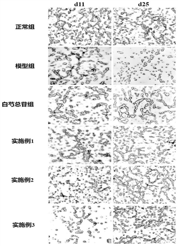 一种新的防治干燥综合症的中药复方及其制备方法、应用