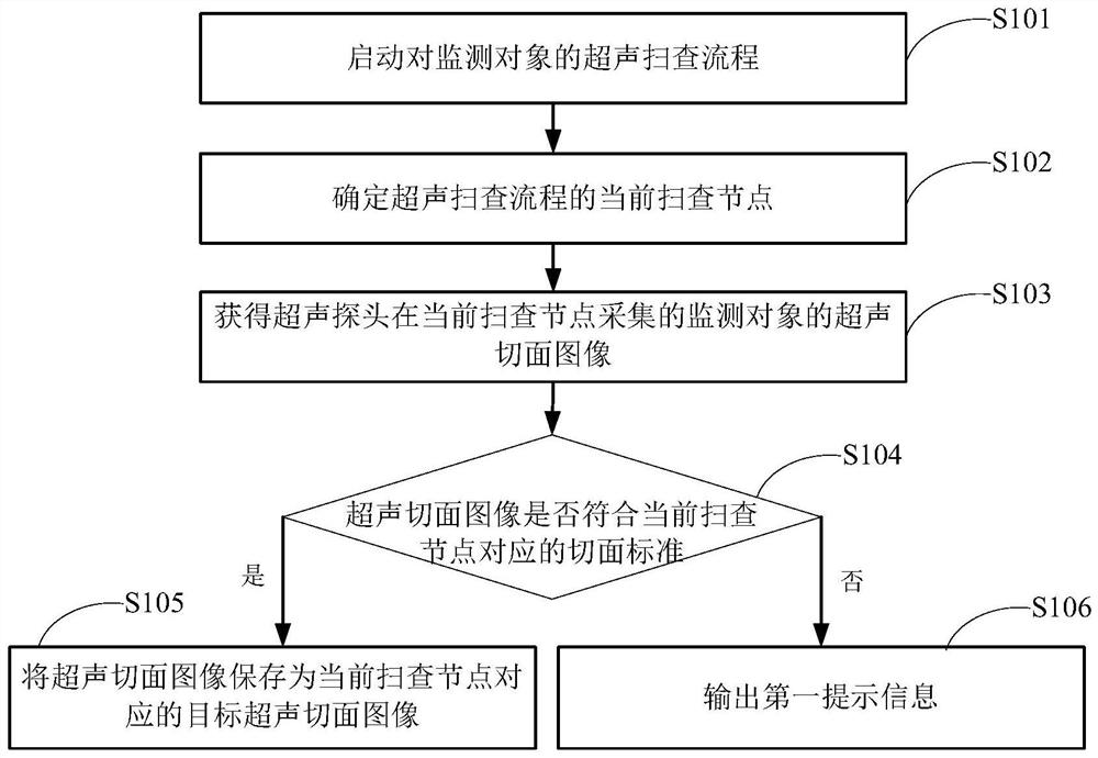 超声图像的检测方法及超声影像设备