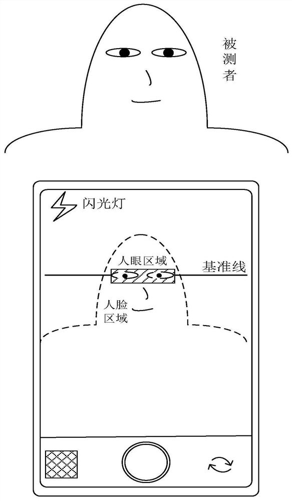 基于眼部外观图像的眼位测量方法、装置、终端和设备