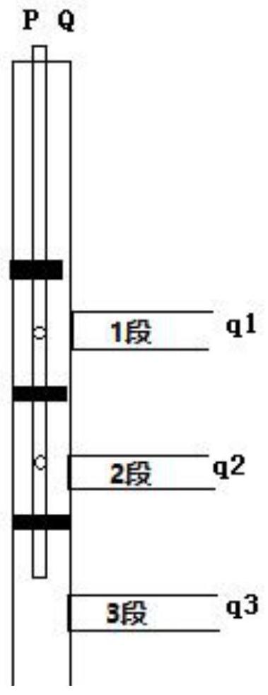 一种适应笼统和分注水井广义视吸水指数计算方法