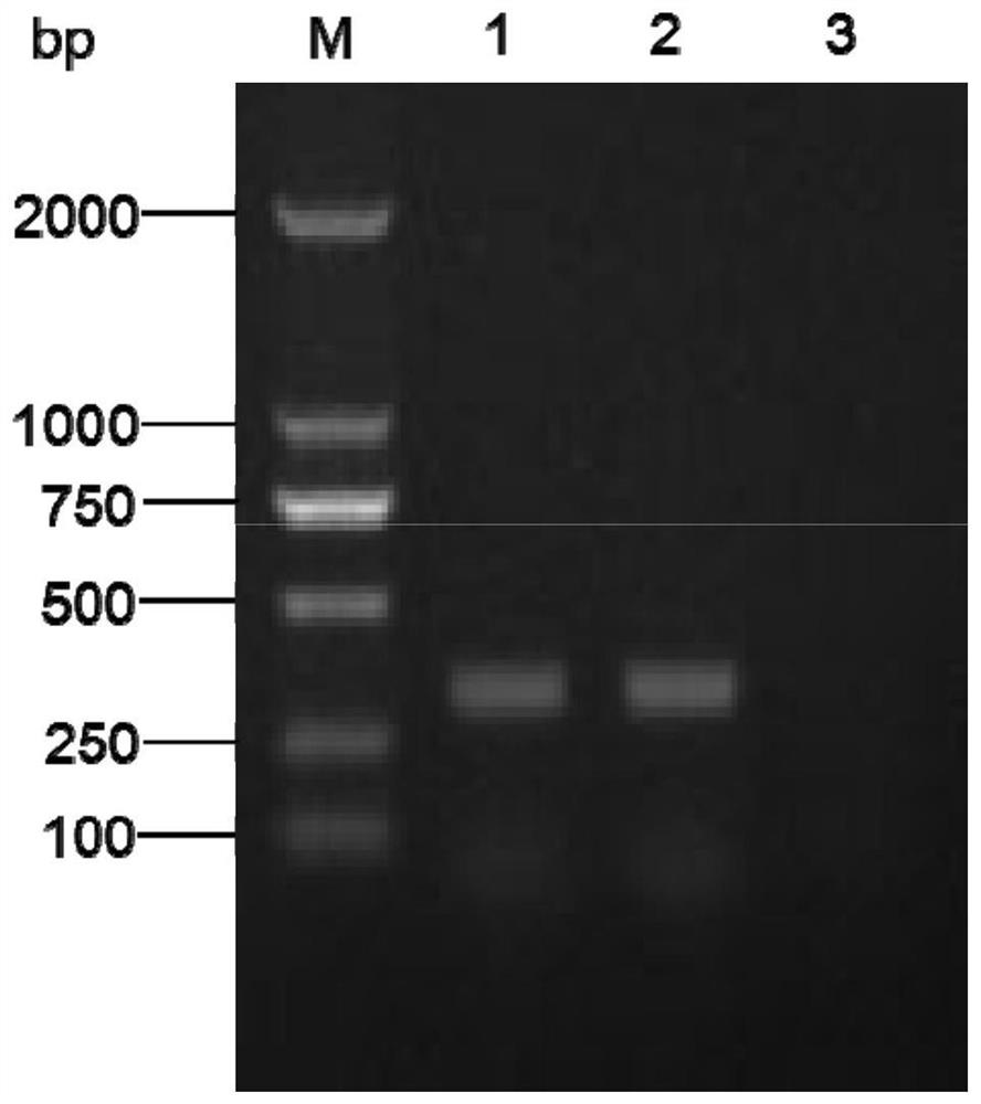 基于微滴数字PCR技术检测猪链球菌的引物和探针及试剂盒和方法