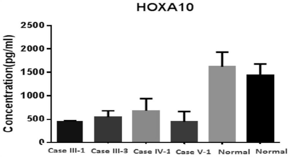 突变的HoxA10基因及应用