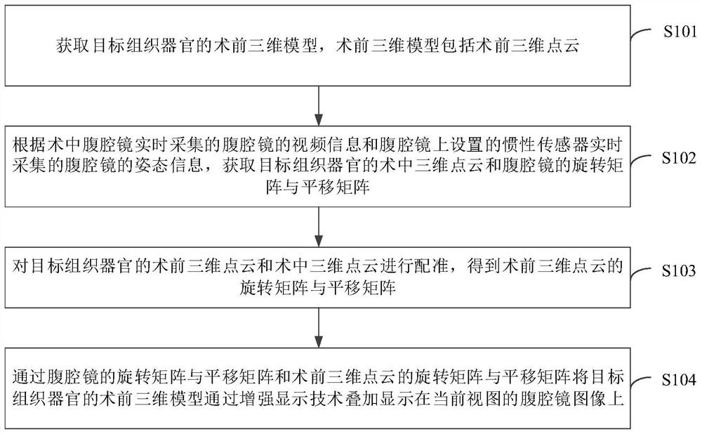 腹腔镜增强现实手术导航方法、装置及电子设备