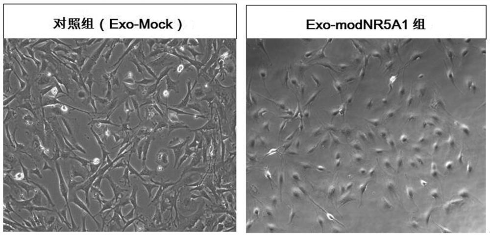 单个转录因子诱导脂肪间充质干细胞分化为睾丸间质样细胞的方法