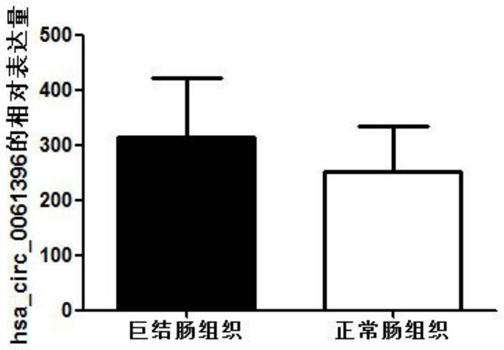 一种先天性巨结肠的标志物及其应用