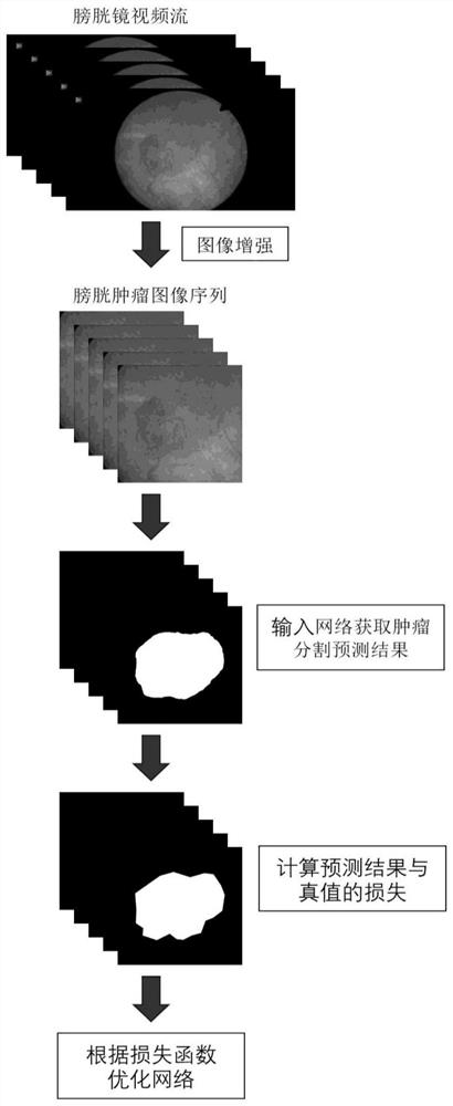 一种基于ORSU-Net的肿瘤图像分割方法和系统