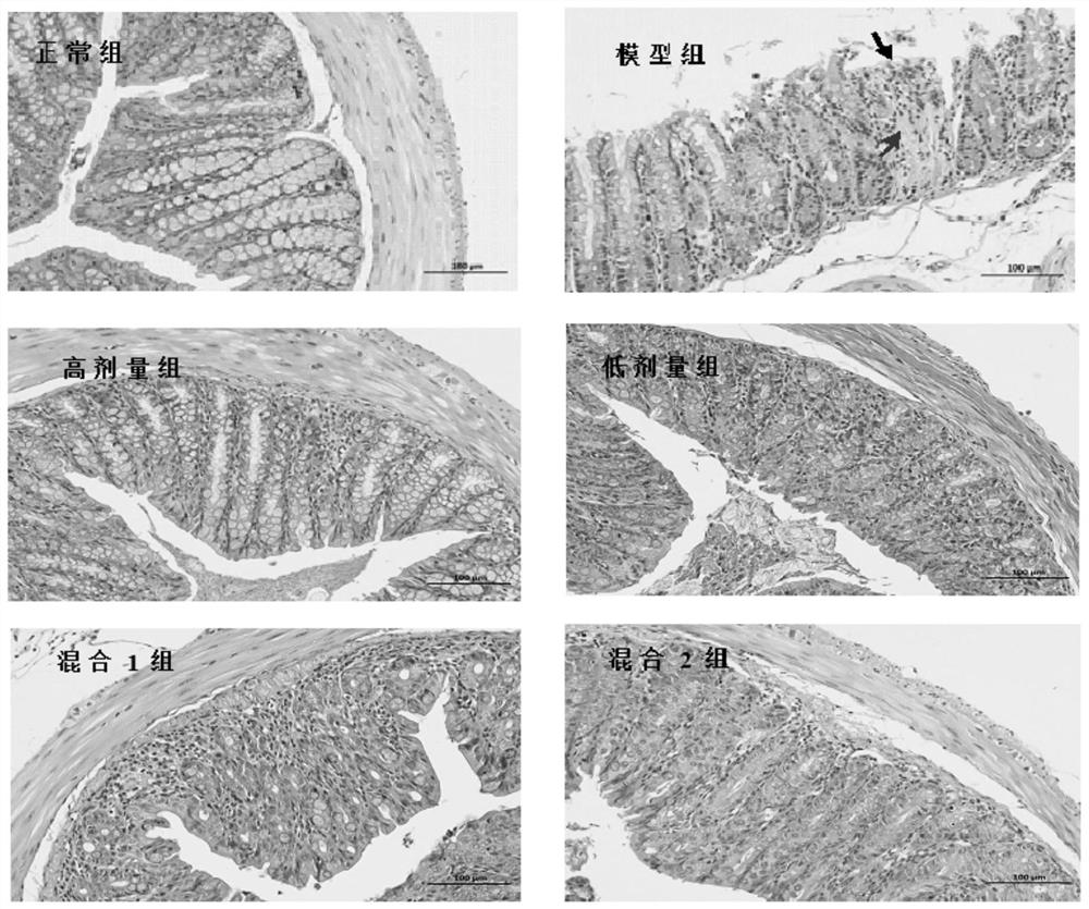 一种含嗜热链球菌MN002的产品的用途及乳制品