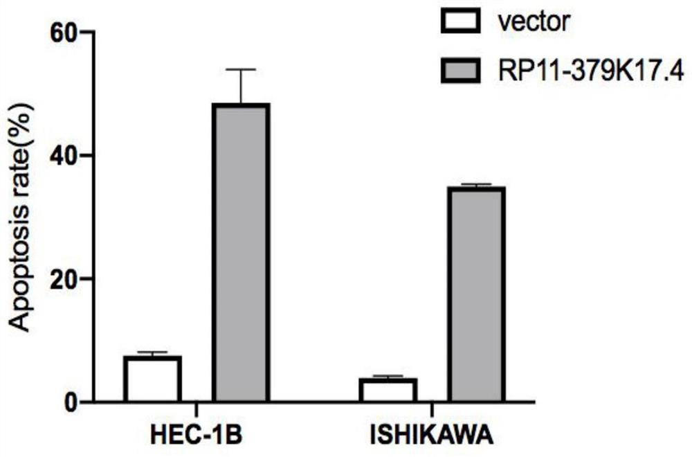 一种RP11-379k17.4过表达在制备治疗子宫内膜癌药物中的用途