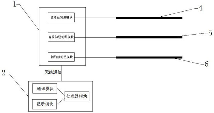 一种骶神经刺激装置