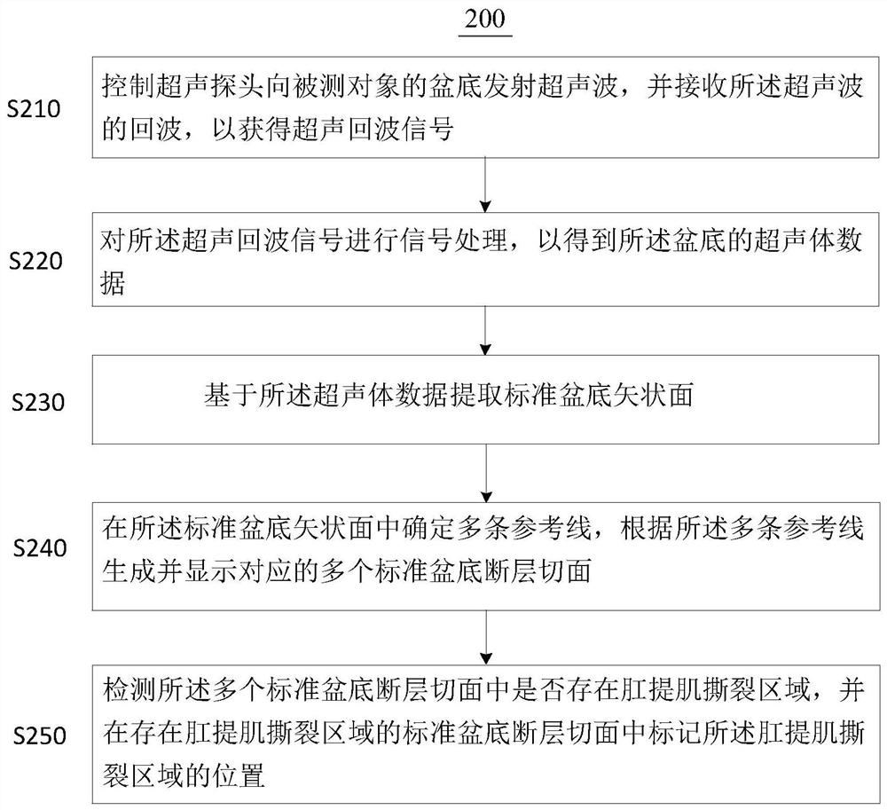 超声盆底成像方法和超声成像系统