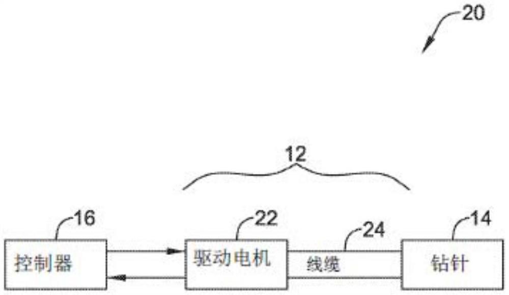 斑块切除电机控制系统