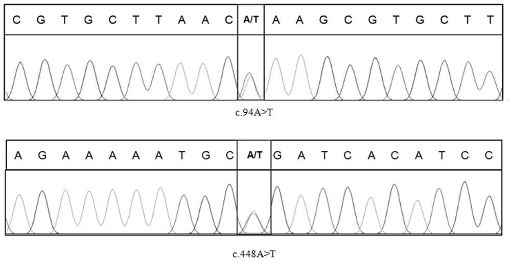 TIMM21突变基因、检测其的引物、试剂盒和方法以及其用途