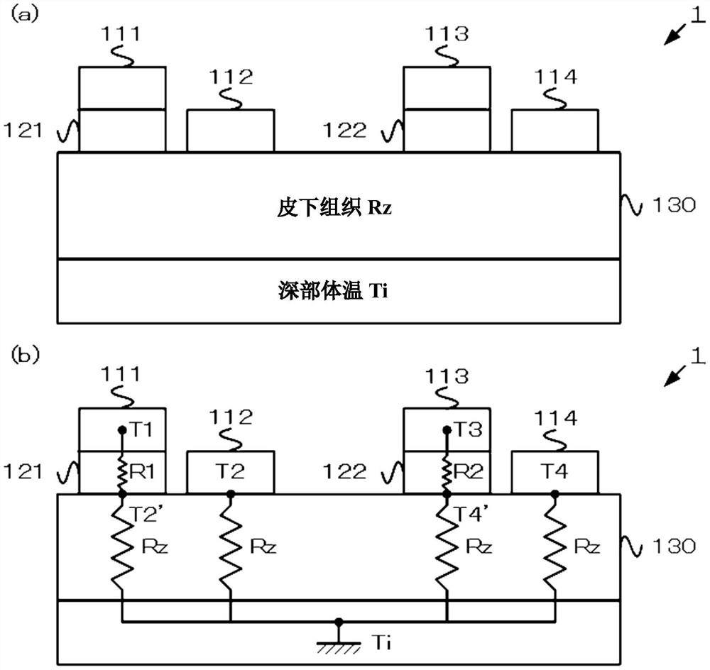 温度传感器单元及体内温度计