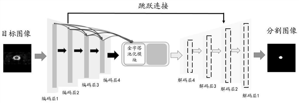 一种CSM图像分割方法、装置、终端设备及存储介质