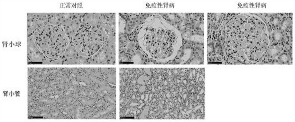 Ptchd3基因或蛋白在制备治疗慢性肾小球肾炎的药物中的
应用