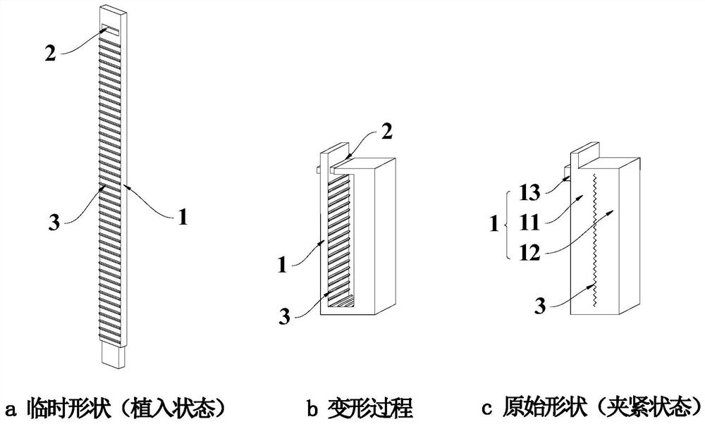 一种具有形状记忆功能的结扎夹