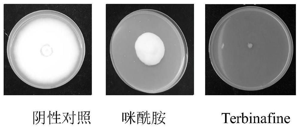 烯丙胺类化合物在制备防治香蕉枯萎病菌的农药杀菌剂的应用