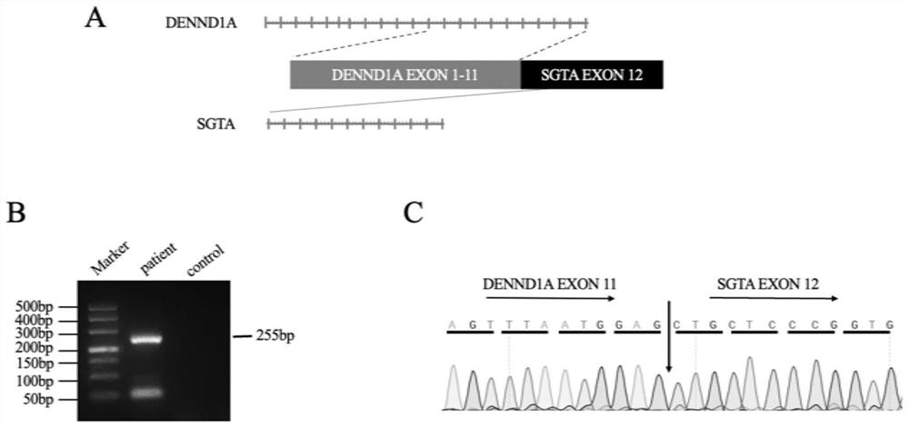 一种DENND1A-SGTA融合基因及其应用和检测试剂盒