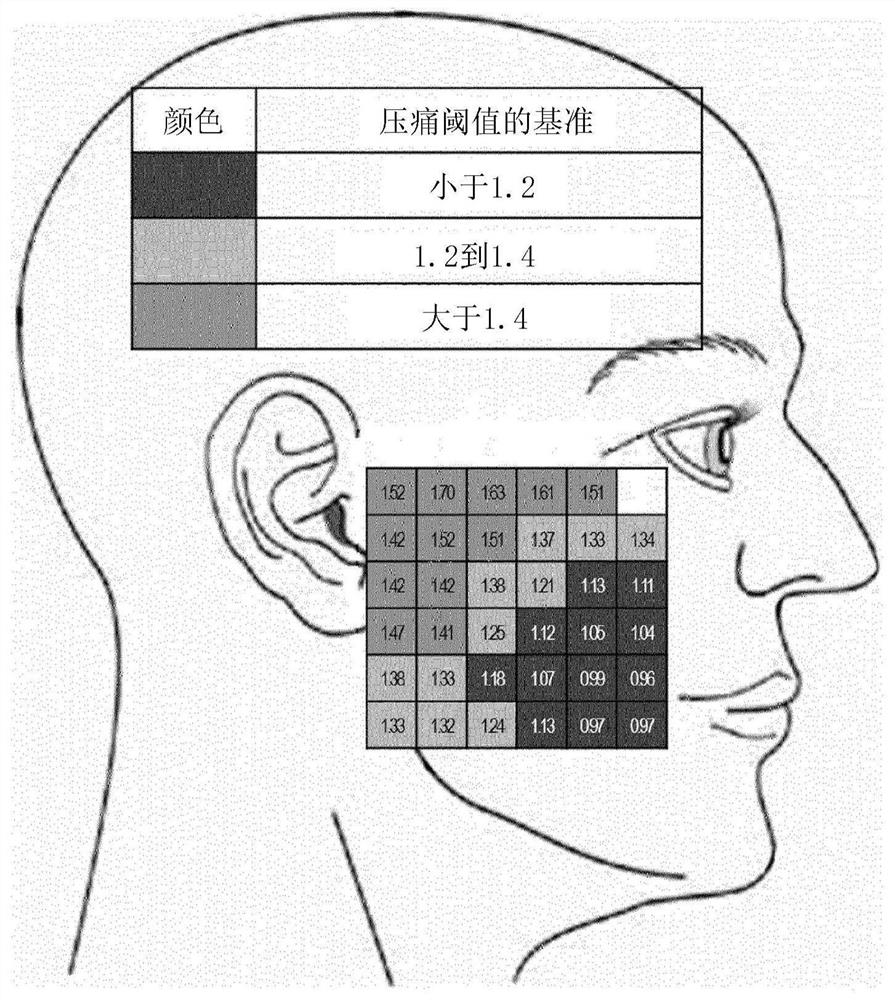 固定在面部的装置