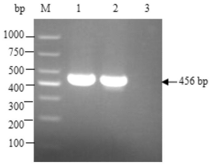 一种猪流行性腹泻病毒S1D片段蛋白的编码基因及其应用