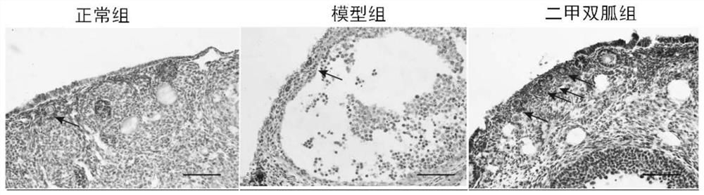 二甲双胍在激活雌性生殖干细胞的应用