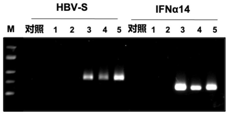 同时表达IFNa14蛋白和人乙肝病毒S蛋白的重组酿酒酵母菌株及制备方法和应用