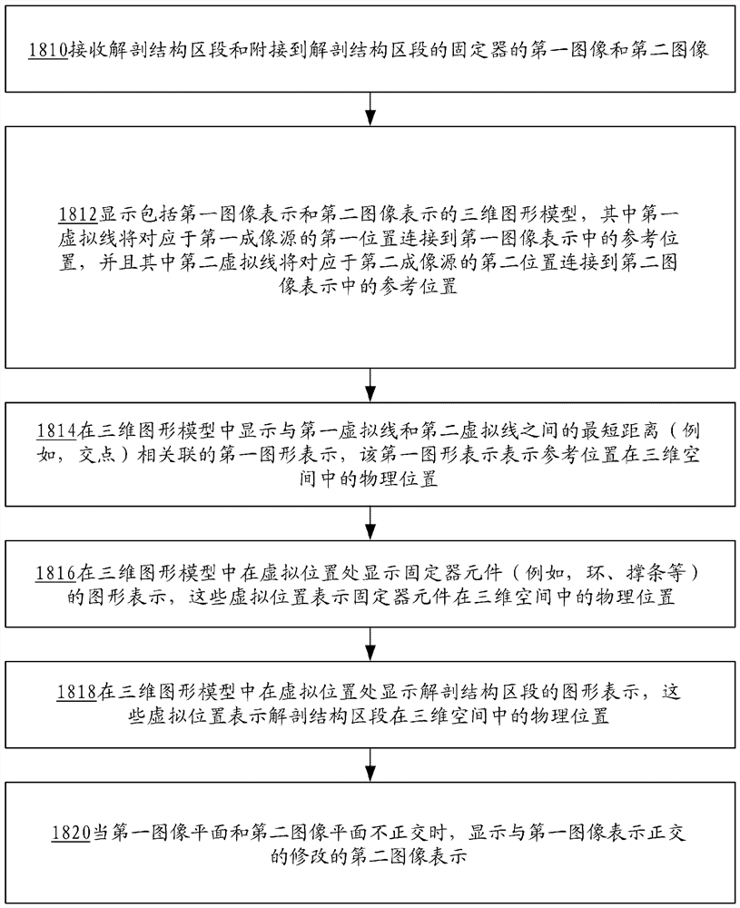 整形外科固定控制与可视化