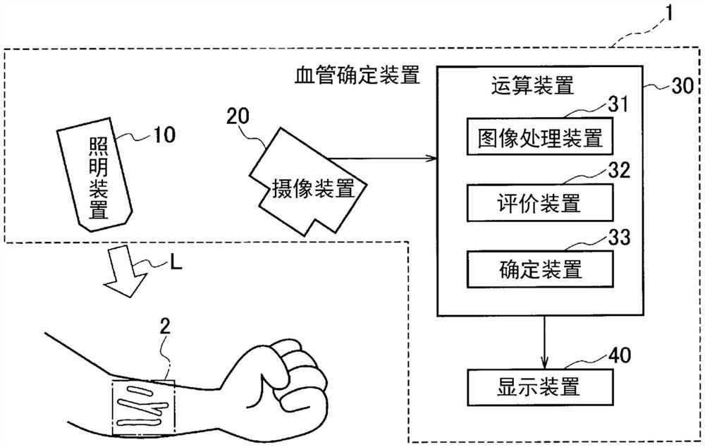 血管确定装置和血管确定方法