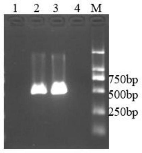一种杀鲑气单胞菌杀鲑亚种PCR检测试剂盒及其使用方法