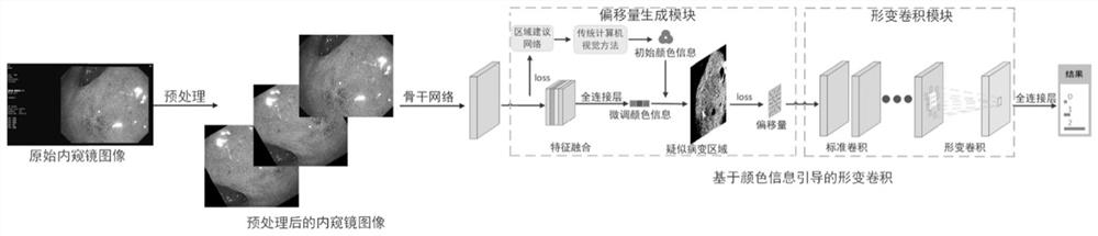 一种肠化生严重程度分类系统