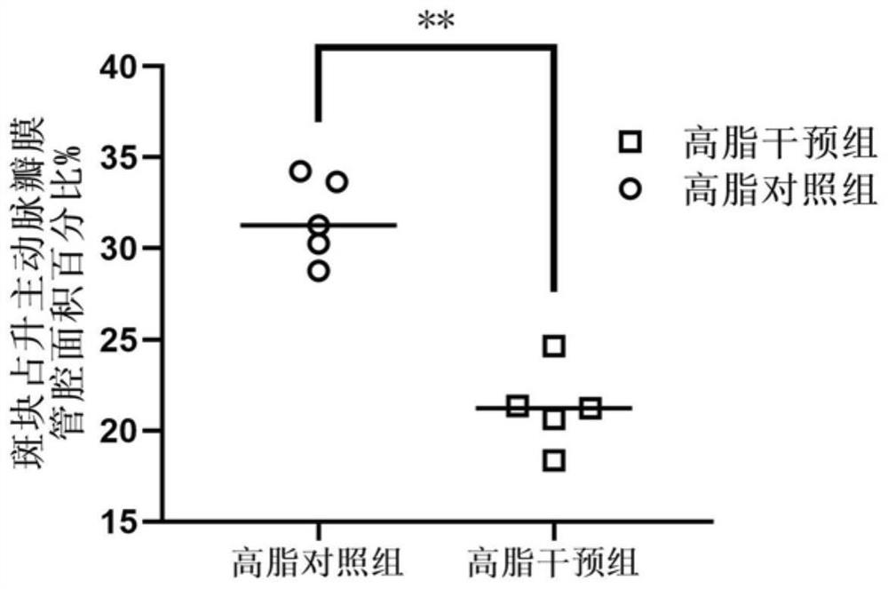 用于防治动脉粥样硬化及斑块不稳定性的化合物及其应用