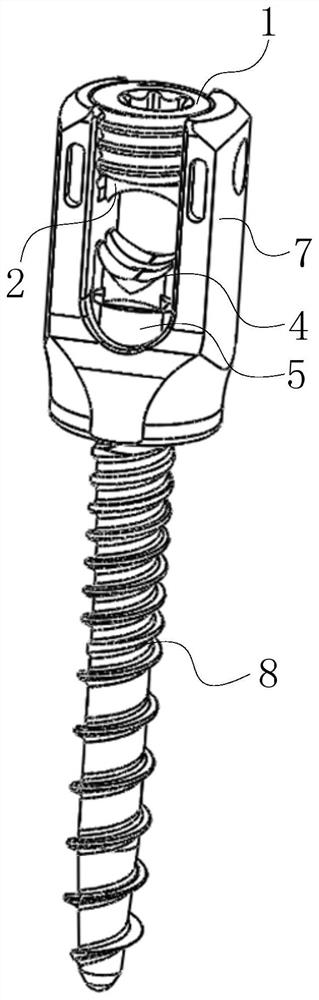 一种仿生微动可调结构的椎弓根螺钉