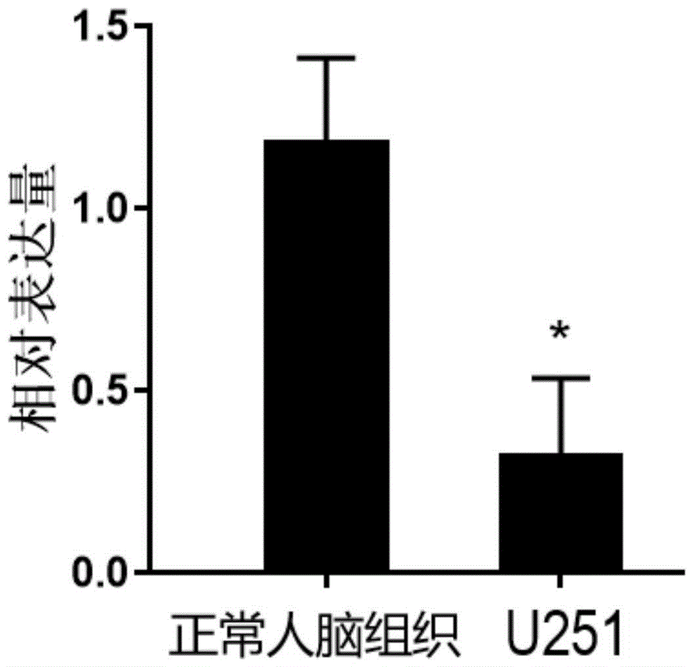 一种脑胶质瘤的生物标志物及其应用